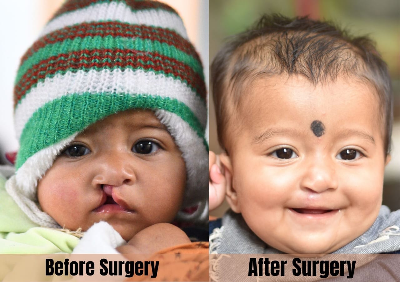 Surgical Consultation